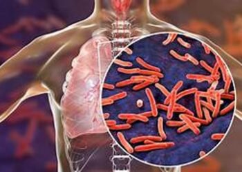 Aumentan los casos de tuberculosis en Argentina: preocupante tendencia