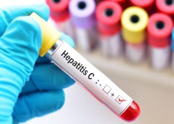 Ocho de cada diez argentinos con hepatitis C aún sin tratamiento