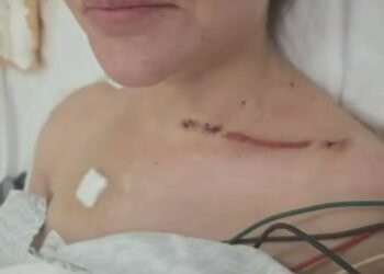 Nadia Beller revela impactantes fotos de sus heridas tras el ataque de sicarios