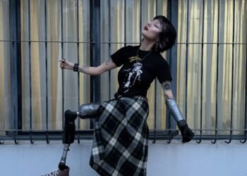 Victoria Rojo: luchando por calidad de vida en medio de la burocracia